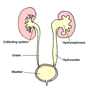 drawing of bladder and kidneys